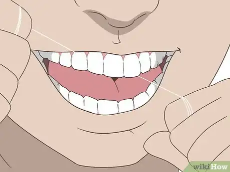 Imagen titulada Treat a Gum Infection Step 14