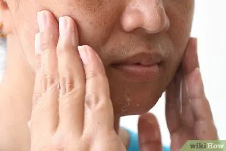 Imagen titulada Apply Toothpaste on Pimples Step 6