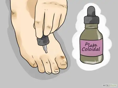 Imagen titulada Use Apple Cider Vinegar for Athlete's Foot Step 10_ES.png