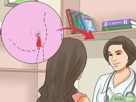 Imagen titulada Heal a Cracked Nipple when Breastfeeding Step 8