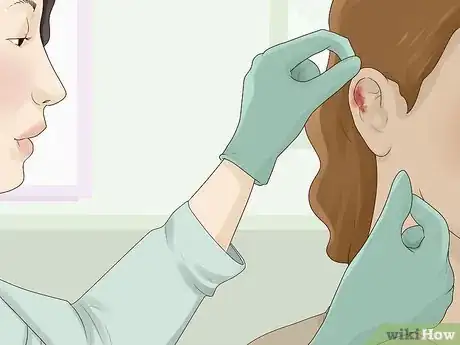 Imagen titulada Clean an Infected Ear Piercing Step 8