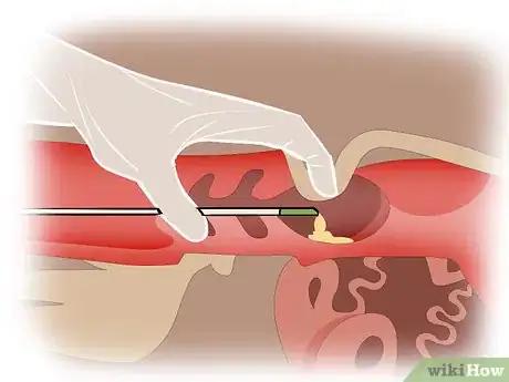 Imagen titulada Artificially Inseminate Cows and Heifers Step 21