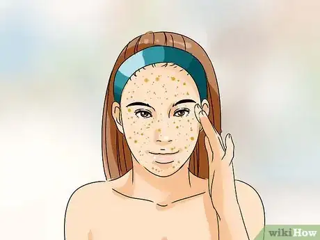 Imagen titulada Remove a Blackhead from Your Forehead Step 8