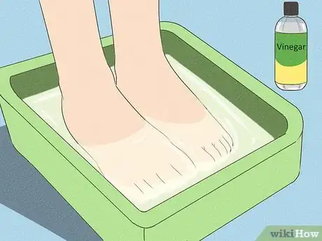 Imagen titulada Get Rid of Foot Odor Step 3