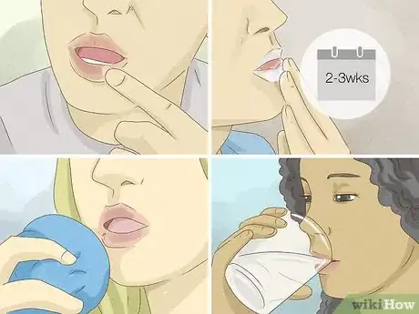 Imagen titulada Heal Lips After Biting Them Step 17