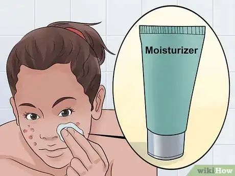 Imagen titulada Decrease the Size of a Pimple Overnight Step 16