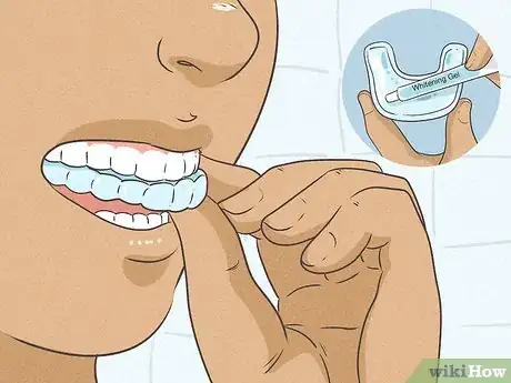 Imagen titulada Whiten Teeth in an Hour Step 8