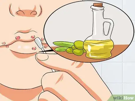 Imagen titulada Ease Herpes Pain with Home Remedies Step 6