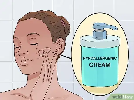 Imagen titulada Decrease the Size of a Pimple Overnight Step 18