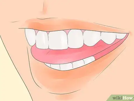 Imagen titulada Cure Bruxism Step 9