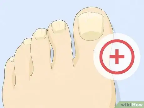 Imagen titulada Have Pretty Toenails Step 4