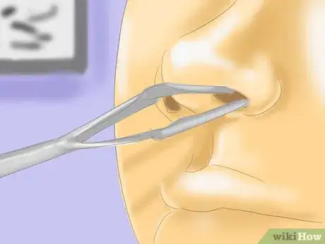 Imagen titulada Keep the Nose Moist to Prevent Nosebleeds Step 11