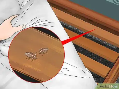 Imagen titulada Identify Bed Bug Bites Step 7