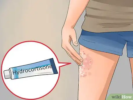 Imagen titulada Treat Contact Dermatitis Step 7
