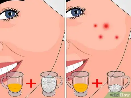 Imagen titulada Remove Dead Skin Using Sugar Step 3