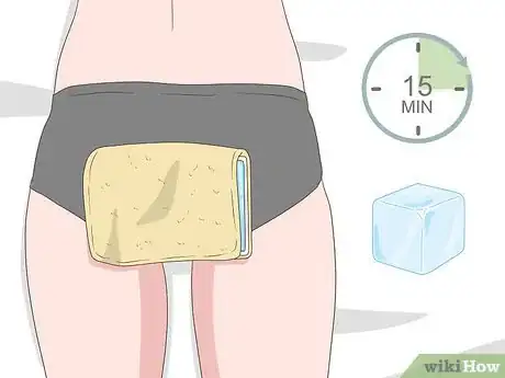 Imagen titulada Get Rid of Hemorrhoids Fast Step 11