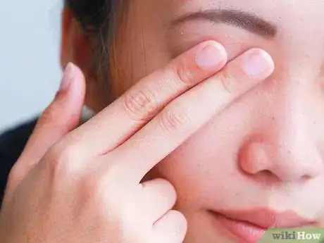 Imagen titulada Get Rid of Puffy Eyes from Crying Step 4