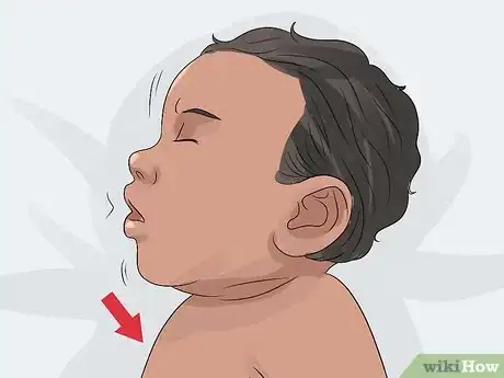 Imagen titulada Spot Meningitis in Babies Step 5
