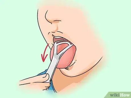 Imagen titulada Get Rid of White Tongue Step 2