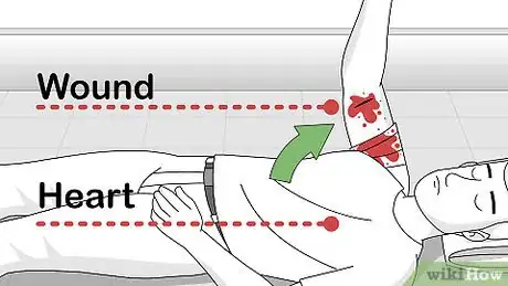 Imagen titulada Attend to a Stab Wound Step 10
