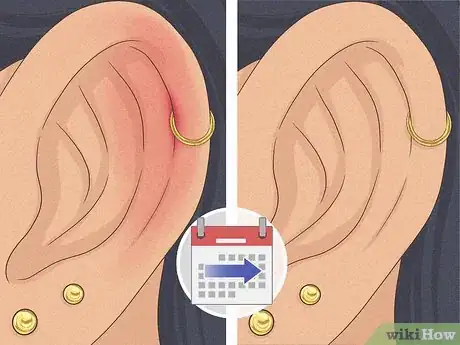 Imagen titulada Is It Safe to Pierce Your Own Cartilage Step 23