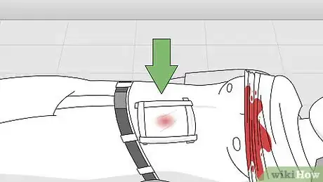 Imagen titulada Attend to a Stab Wound Step 11