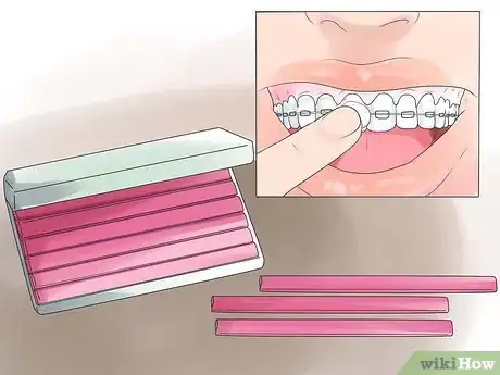Imagen titulada Eat With Braces Step 12