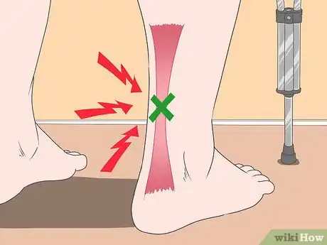 Imagen titulada Wrap an Achilles Tendon Step 13