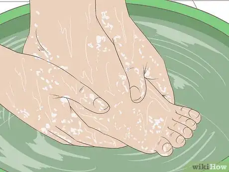 Imagen titulada Remove Dry Skin from Your Feet Using Epsom Salt Step 13