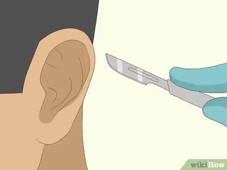 Imagen titulada Improve Your Hearing Step 5