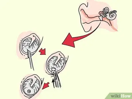 Imagen titulada Unclog the Inner Ear or Eustachian Tube Step 13