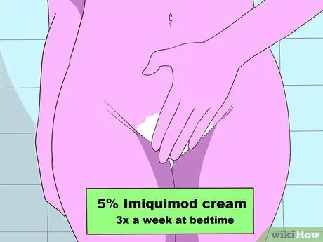 Imagen titulada Get Rid of Genital Warts at Home Step 3