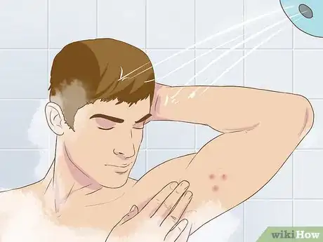 Imagen titulada Get Rid of a Zit on Your Armpit Step 1