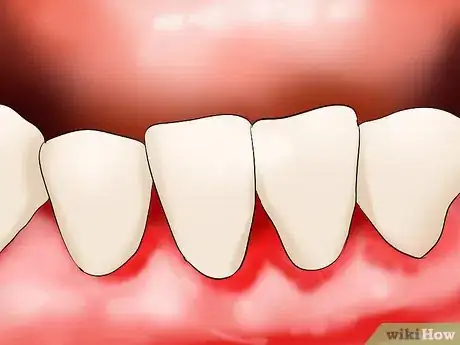 Imagen titulada Care for Your Teeth As a Senior Citizen Step 7