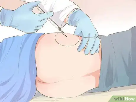 Imagen titulada Give an Injection Step 18