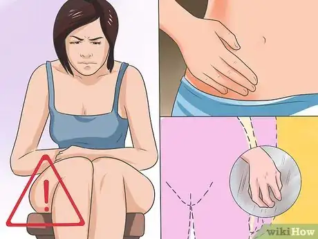 Imagen titulada Treat a Yeast Infection Step 1