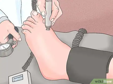 Imagen titulada Take an Ankle Brachial Index Step 8