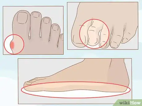 Imagen titulada Get Healthy, Clean and Good Looking Feet Step 16