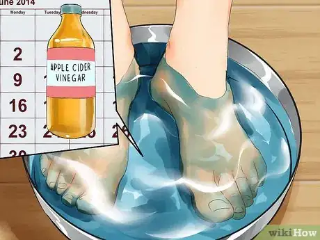 Imagen titulada Heal Dry Skin on Your Feet Step 2