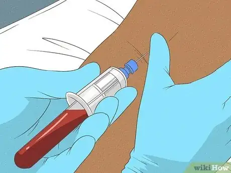 Imagen titulada Diagnose Vitiligo Step 7