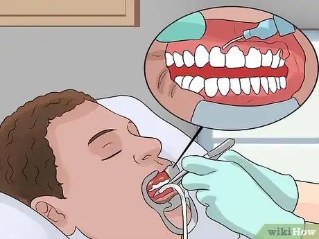 Imagen titulada Prepare for the Day That You Get Braces Step 1