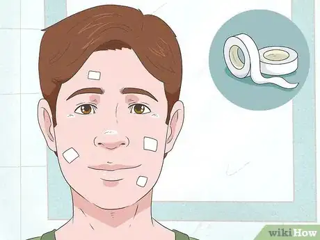 Imagen titulada Heal Your Face After Picking Step 9