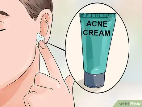 Imagen titulada Get Rid of Pimples Inside the Ear Step 5