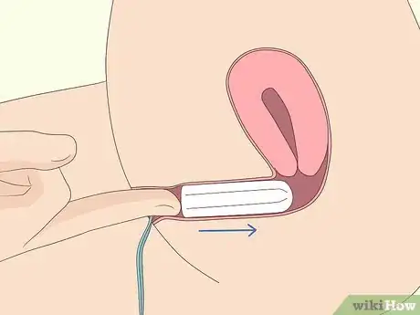 Imagen titulada Insert a Tampon Without Applicator Step 8