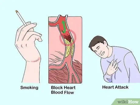 Imagen titulada Study Pathology Step 3