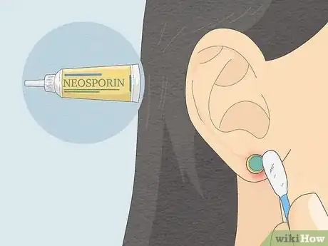 Imagen titulada Clean Your Ear Piercing Step 5