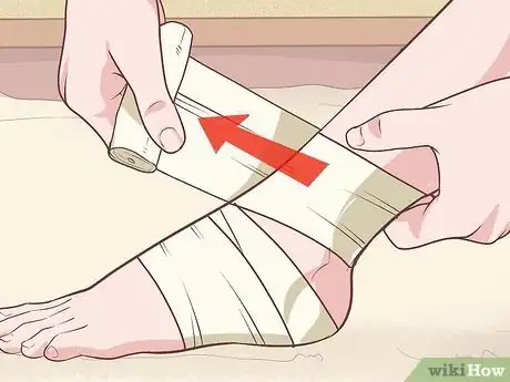 Imagen titulada Relieve Plantar Fasciitis Pain Step 9