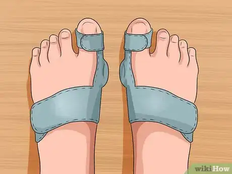 Imagen titulada Get Rid of Bunions Step 8