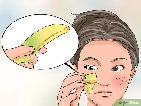 Imagen titulada Get Rid of Large Pores and Blemishes Step 11