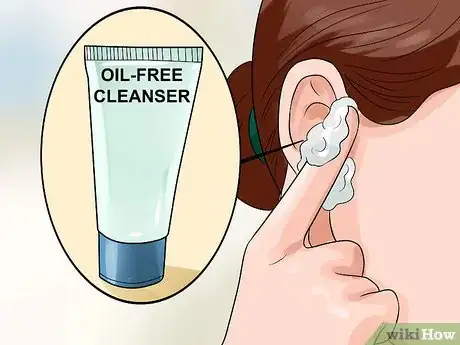 Imagen titulada Get Rid of Pimples Inside the Ear Step 4